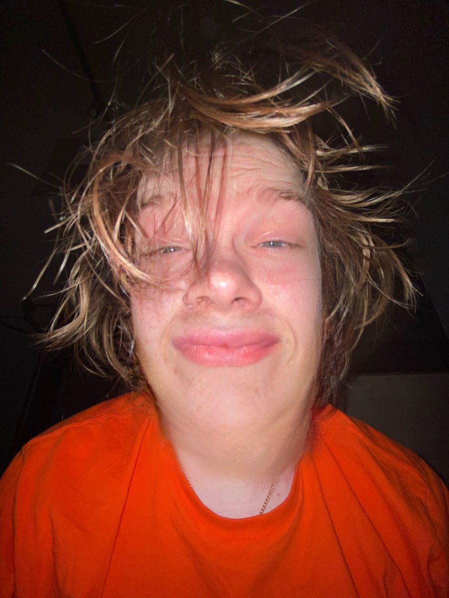 just shaved my beard off, thoughts ? 😊