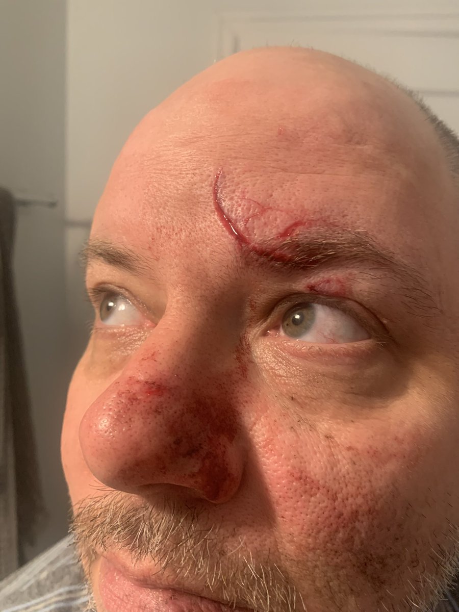 PNWFietser's tweet photo. This is the face of American cycling. #carsaredeathmachines #bikecrash https://t.co/uDlJTrctx4