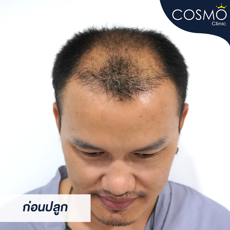Cosmo Clinic on Twitter: Cosmo Clinic On Twitter: