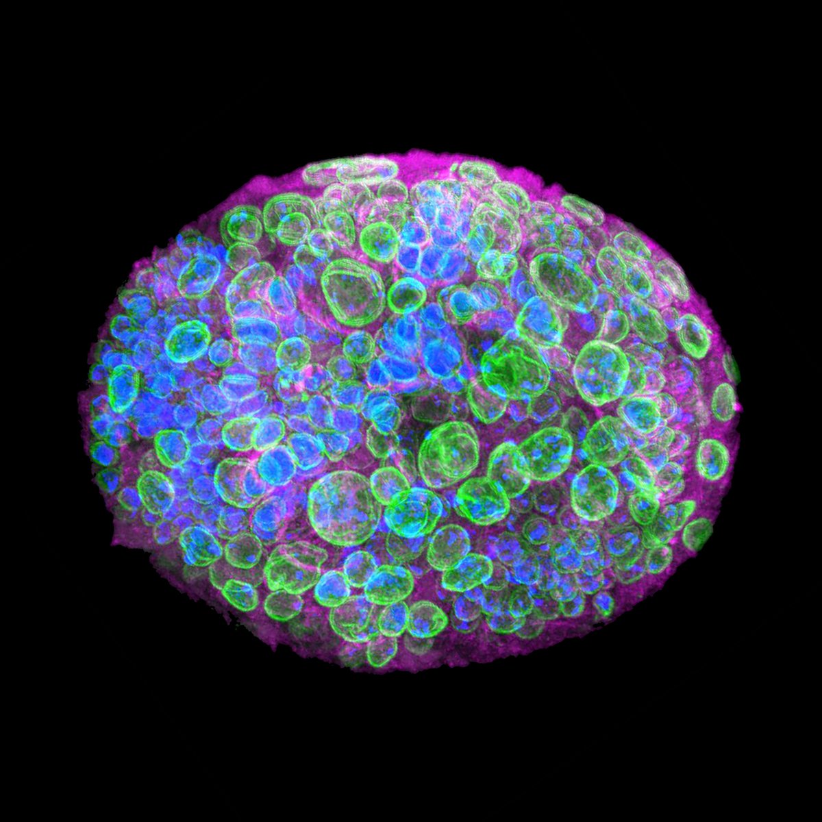 UCL Laboratory for Molecular Cell Biology (@lmcb_ucl) on Twitter photo Delighted to announce the winner of this month's #LMCBImageoftheMonth competition. Congratulations <a href="/Roubinet31/">Chantal Roubinet</a> (@PichaudLab <a href="/lab_baum/">Buzz Baum's Lab</a>)! The image is titled "Beautiful brain" and shows a 3D Drosophila larval brain lobe, stained for lamin (green), chromatin (blue), tubulin (purple) Delighted to announce the winner of this month's #LMCBImageoftheMonth competition. Congratulations <a href="/Roubinet31/">Chantal Roubinet</a> (@PichaudLab <a href="/lab_baum/">Buzz Baum's Lab</a>)! The image is titled "Beautiful brain" and shows a 3D Drosophila larval brain lobe, stained for lamin (green), chromatin (blue), tubulin (purple)