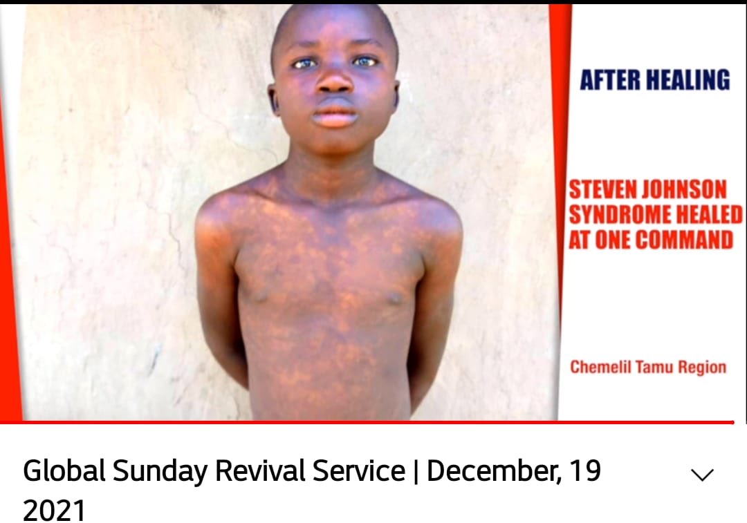 rettanambala's tweet photo. The LORD once again defeated the medical knowledge. Truly what is impossible with men, With GOD it’s possible
 #MenengaiHealingCrusade https://t.co/AYzIZFh4hF