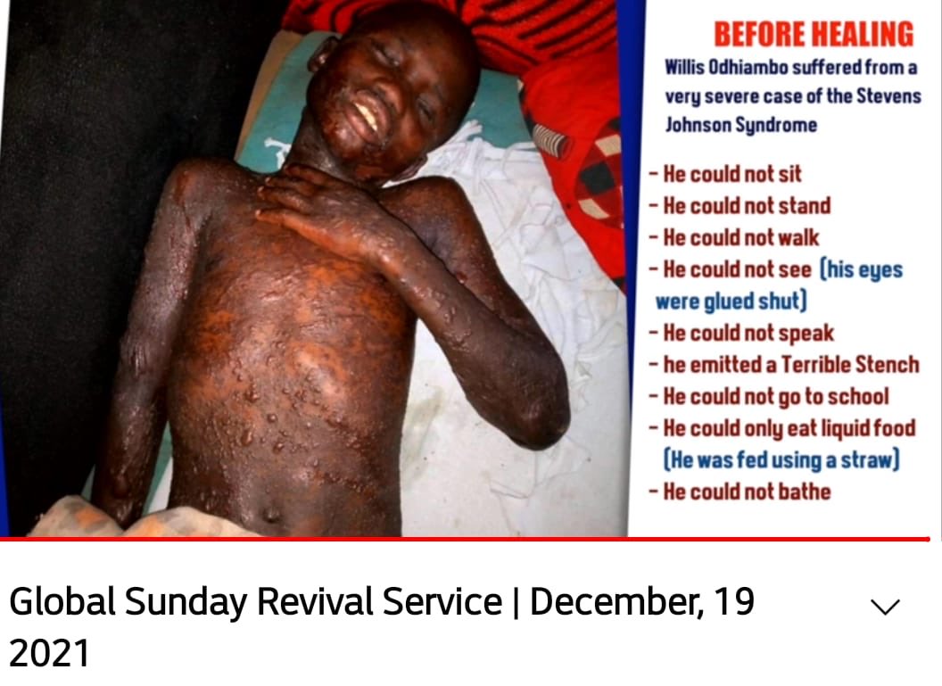 rettanambala's tweet photo. The LORD once again defeated the medical knowledge. Truly what is impossible with men, With GOD it’s possible
 #MenengaiHealingCrusade https://t.co/AYzIZFh4hF