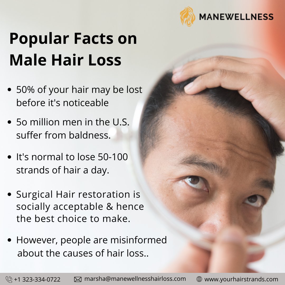 Hair Loss in Men Award Winning Trichology Clinic Dorset