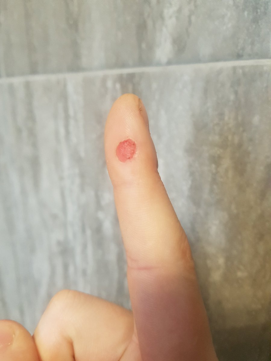 TheDartFox's tweet image. @PerformanceDart drunk me decided he was Gordon 'Effin Ramsey so now the practice routine is postponed for a few days.👏🤣