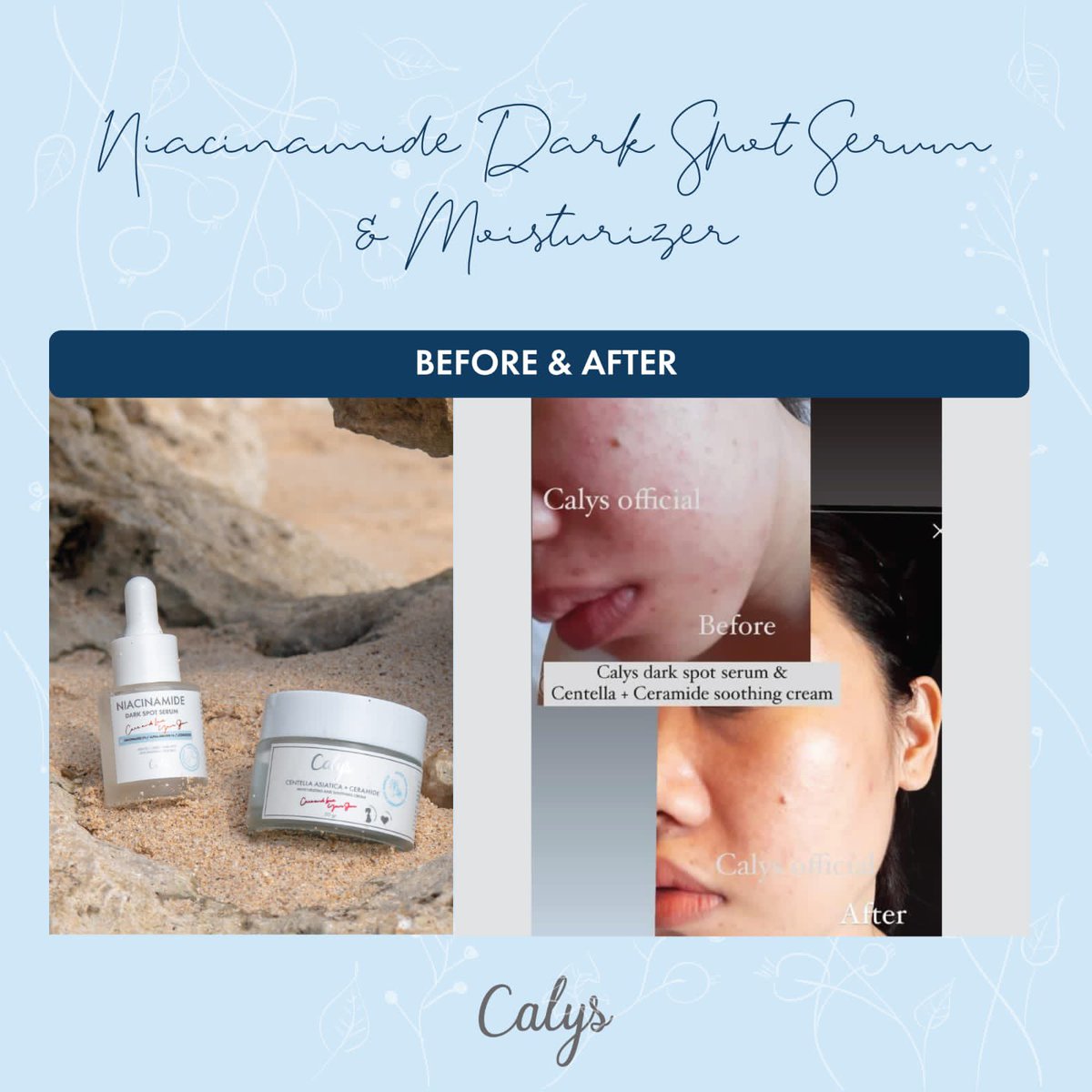 calys_official's tweet photo. Ini dia hasil penggunaan Niacinamide Dark Spot Serum 🥰
Happy banget kalo ngeliat kalian berhasil mengatasi masalah kulit pakai Calys💙 https://t.co/upUqkDXPXl