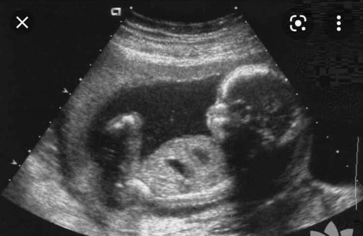 Dertsiz tasasız yaşadığım günlerden bir kareyi sizlerle paylaşmak istedim..
                 😄🤣☺️😔
İnsan eskiye özenir de  kardeşim en eskiye deyil 😔😔