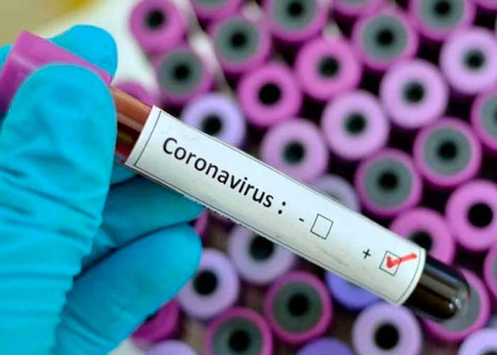 Informe COVID-19 Bahía Blanca
🗓️ 20/12/2021
Casos totales: 46027
- Confirmados nuevos: 3
- Recuperados nuevos: 14
- Decesos nuevos: 0 
- Casos activos: 69
Más info y datos en la Sala de Situación Covid-19
👉🏼 gobiernoabierto.bahia.gob.ar/panel-covid