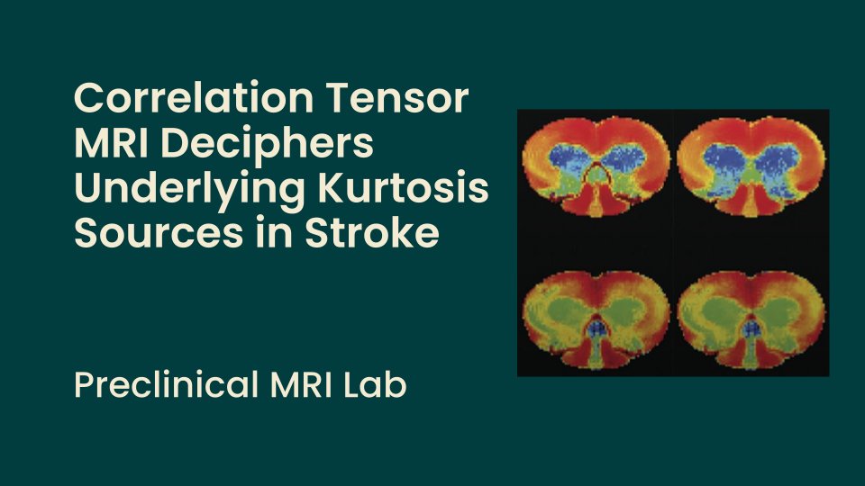 Neuro_CF's tweet photo. New paper from @ShemeshL in @NeuroImage_EiC!
👉https://t.co/bGim6wC1Kw
Congrats to Rita Alves, @RafaelNetoHenr1, Leevi Kerkela, Cristina Chavarrías, @sunenj & Noam Shemesh! 👏
@ChampalimaudF #MRI #dMRI #CTI #kurtosis #ischemia #stroke #strokeimaging #neuroimaging https://t.co/6J1TTC9ncw
