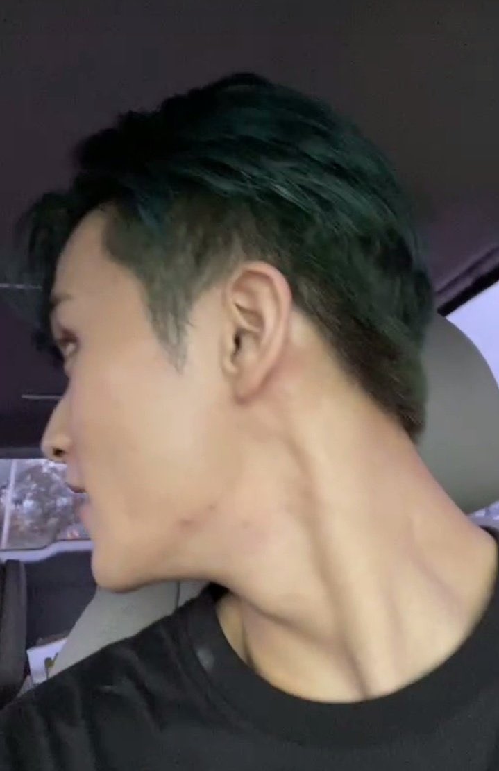 อันเดอร์คัทมาร์คลีน่ะเหรอ ก็ไหว้พ่อซิคะ!