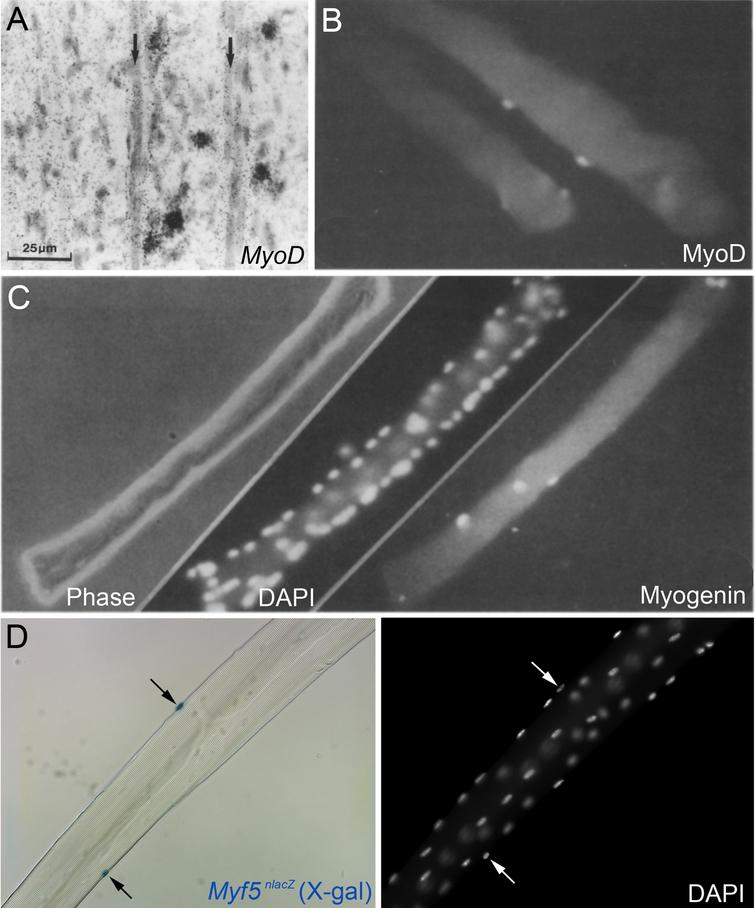 On the 60th anniversary of the discovery of the satellite cell, this review from <a href="/KingsCollegeLon/">King's College London</a> highlights breakthroughs in muscle stem cell research
Check it out here: bit.ly/3FeESyo
And remember, for December, all articles in this special issue are #openaccess!