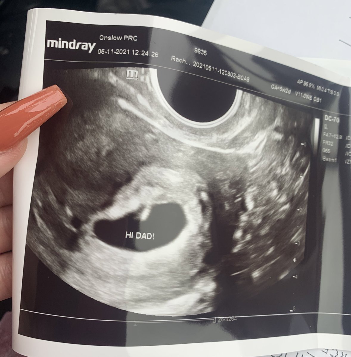 nnnicccccole's tweet photo. My dreams really did come true🤱🏻💜 https://t.co/2GQecZ6RAa