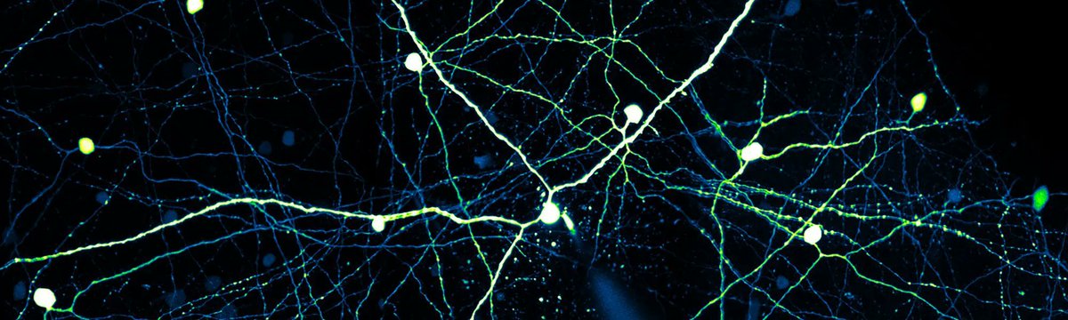 Scientifica_Int's tweet photo. #SciMethods: This technical note describes two approaches to integrating visual stimulation of the retina into a multiphoton microscope. #multiphoton #AppNote #neuroscience #science #microscopy 
https://t.co/1Nl7Adq1VI https://t.co/Z868vdGV8V