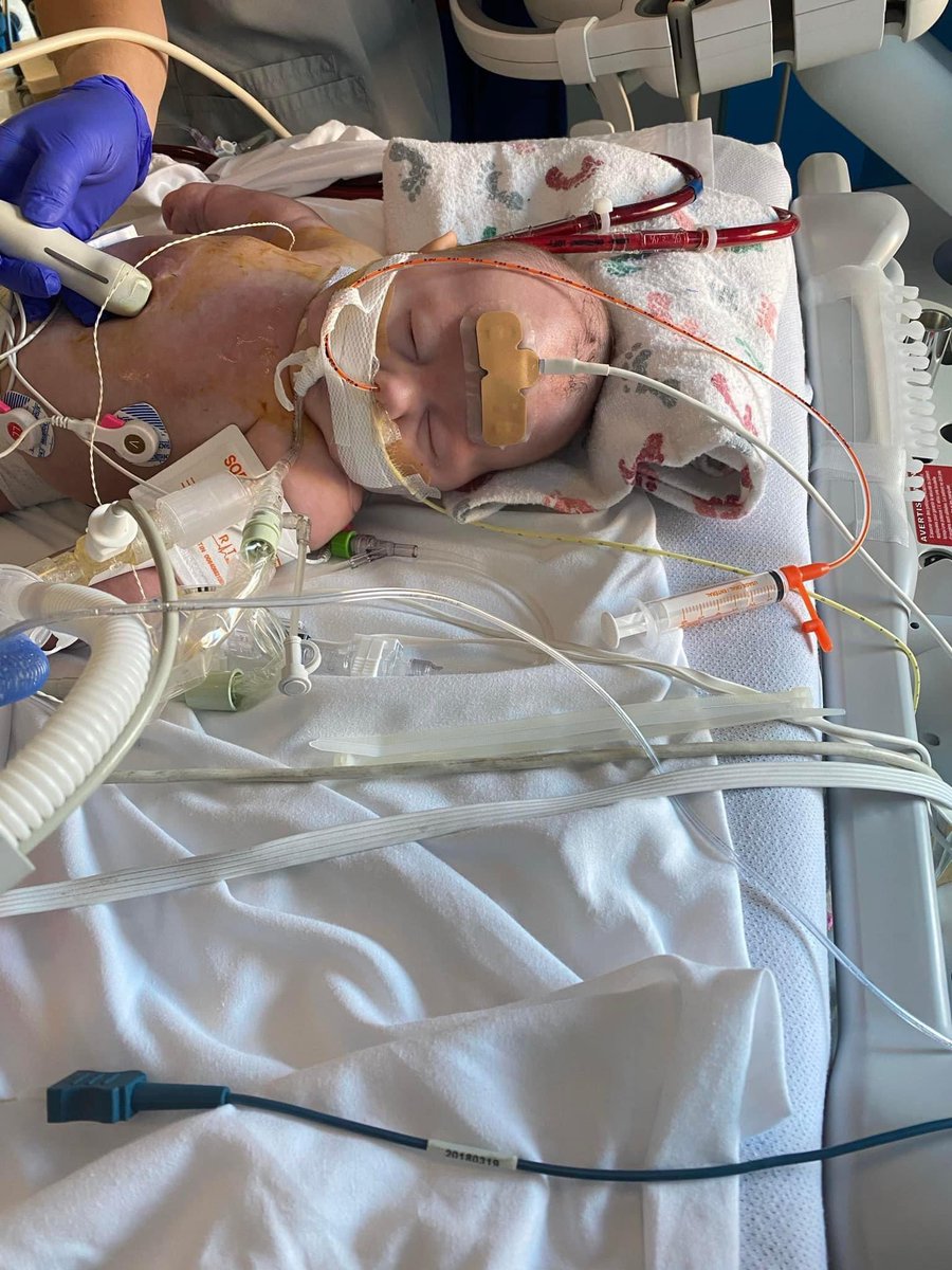 Simon's Law tweet media