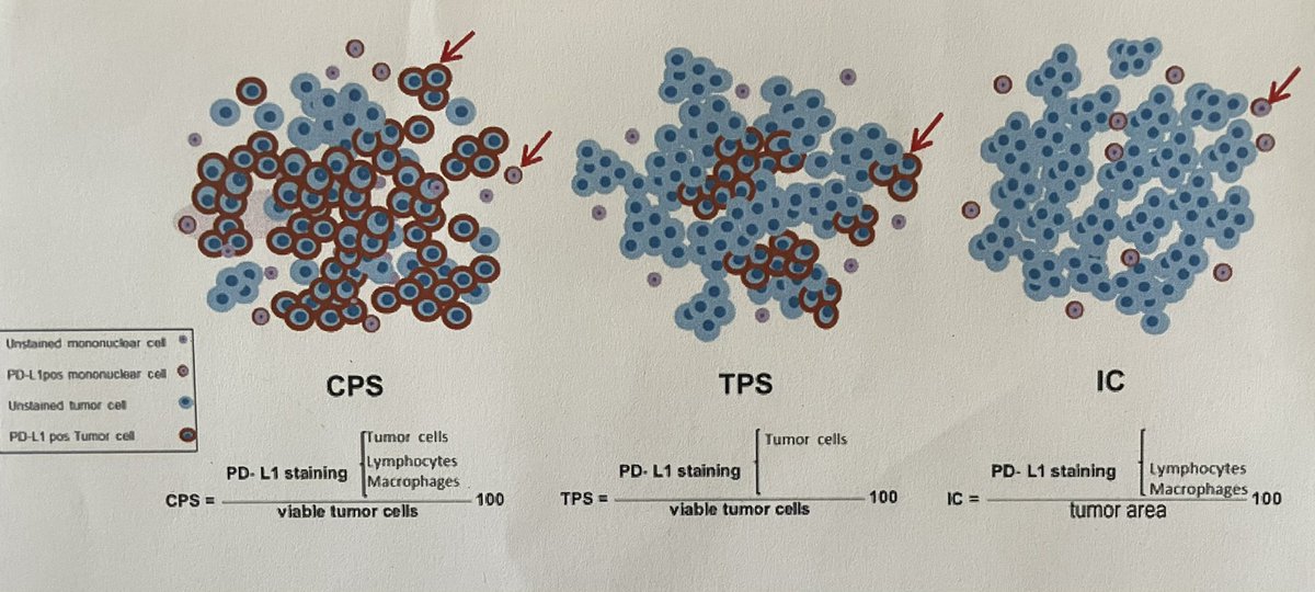 MdYaziji's tweet photo. Best PD-L1 scoring systems illustration I have seen so far… https://t.co/0pvDRl2Iy1