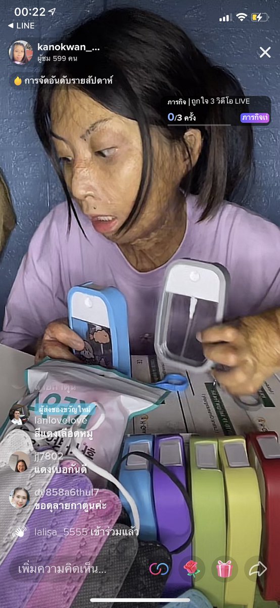 ทุกคน อยากแชร์ต่อจริงๆ น้องไปทำงานที่โรงงานดอกไม้ไฟ ตอนอายุ 11ปี ได้ค่าแรงวันละร้อย แล้วโรงงานระเบิด ทำให้น้องโดนไฟคลอกทั้งตัว น้องทัศนคติดีมาก พูดเพราะมากๆ และสู้ชีวิตมากๆ น้องบอกไม่อายที่เป็นแบบนี้ ตอนนี้น้องขายแมสใน Tiktok วันนึงน้องไลฟ์ 4-5 รอบ #โควิด19 
#โควิดสายพันธุ์ใหม่