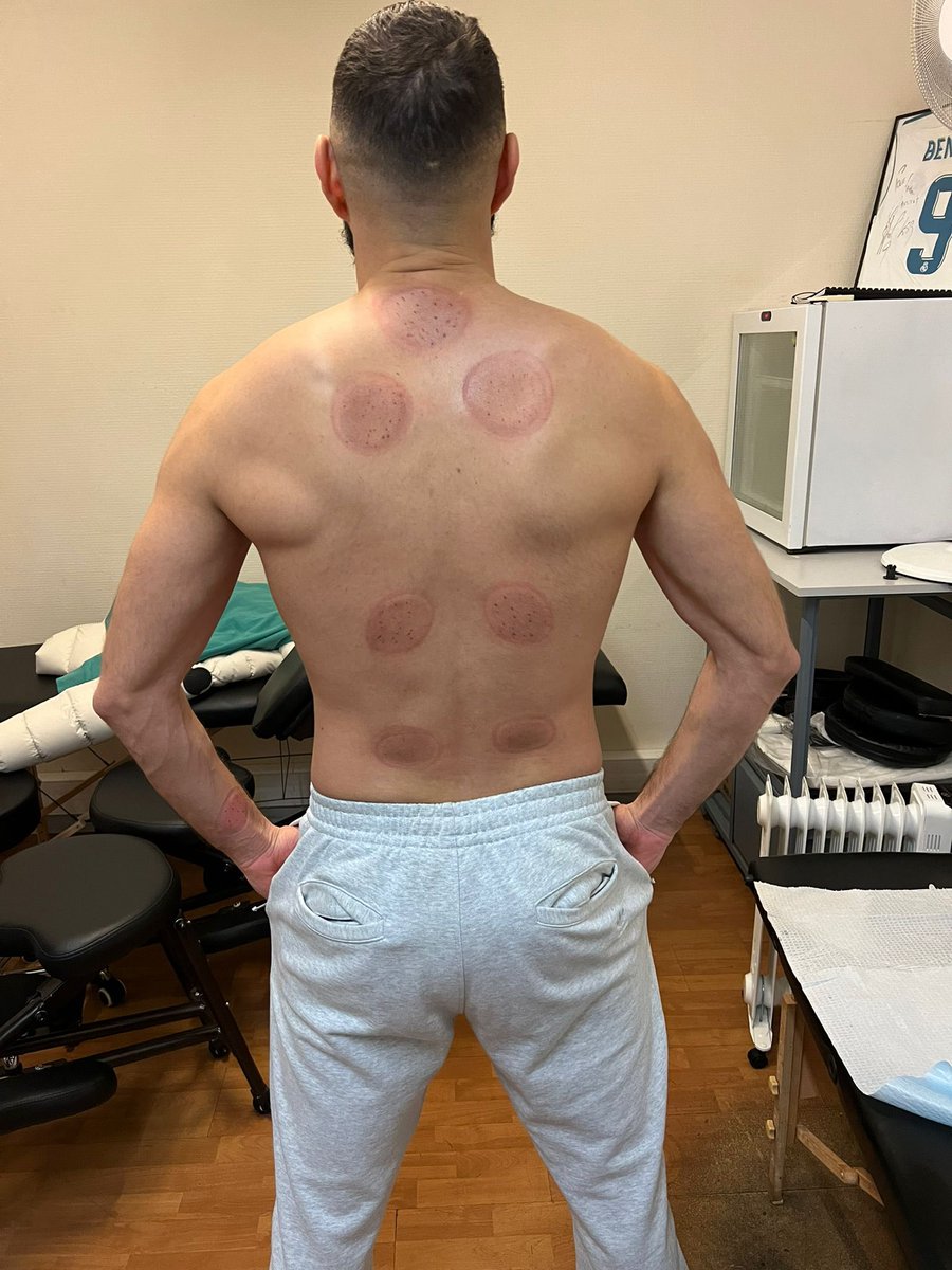 Rien de plus vrai… #Recovery #Hijama #Alhamdulillah