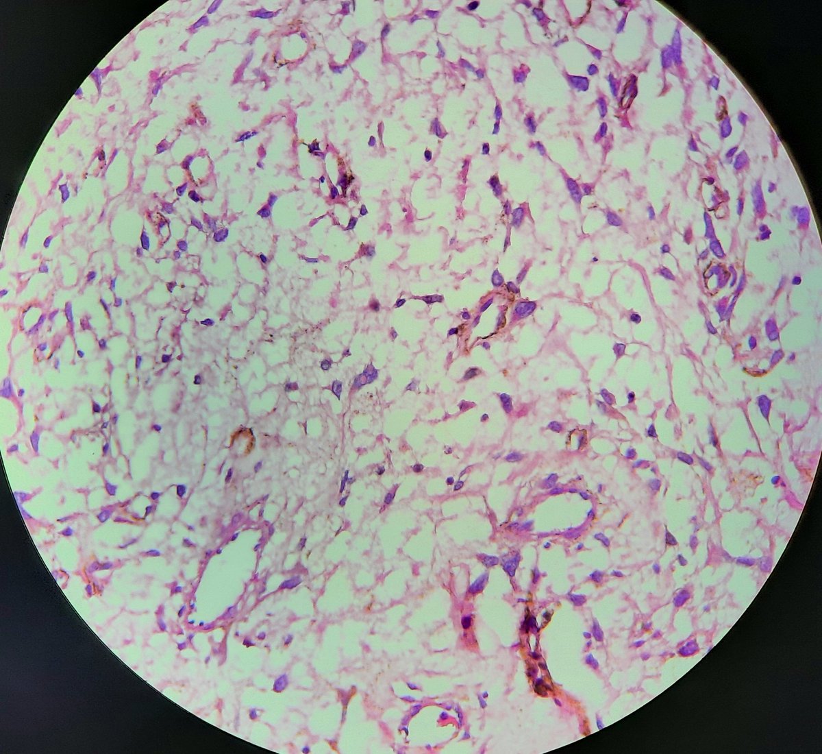 cherradi07's tweet photo. 30 old year man. What's your diagnosis? https://t.co/o0vmLfN26z
