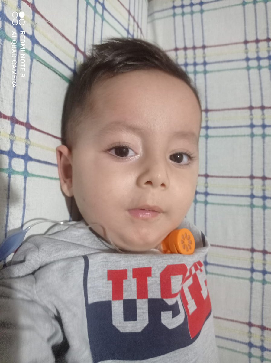 furkansmatip's tweet photo. Furkan tedavisine doğru son adımlarını atıyor. Kahramanları, son düzlükte Furkan'a yardım etmeye devam ediyor
Furkan'ın ilacı Dubai'de. İlacına kavuşmasına son %8 kaldı. Son bir gayretle Furkan'ı uçağına bindirelim🙏

#a101 Halk TV Hazine #enuzungece #Binance #döviz #gramaltın https://t.co/fCcRwgdnBx