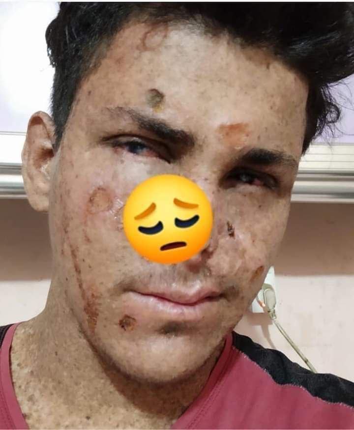 صـارله اڪـثر من سـنه ونص يناشد ومحد يستجاب اله عده مرض (سرطان بالجلد ) ...وياڪل بي وماشايف الشمـس صارلة كذا سنة حملة انقاذ احمد فلا تقصروا لنجعلها قضيه كقضية مريم

#انقذو_احـمد
#انقذوا_احمد_الجعيفري