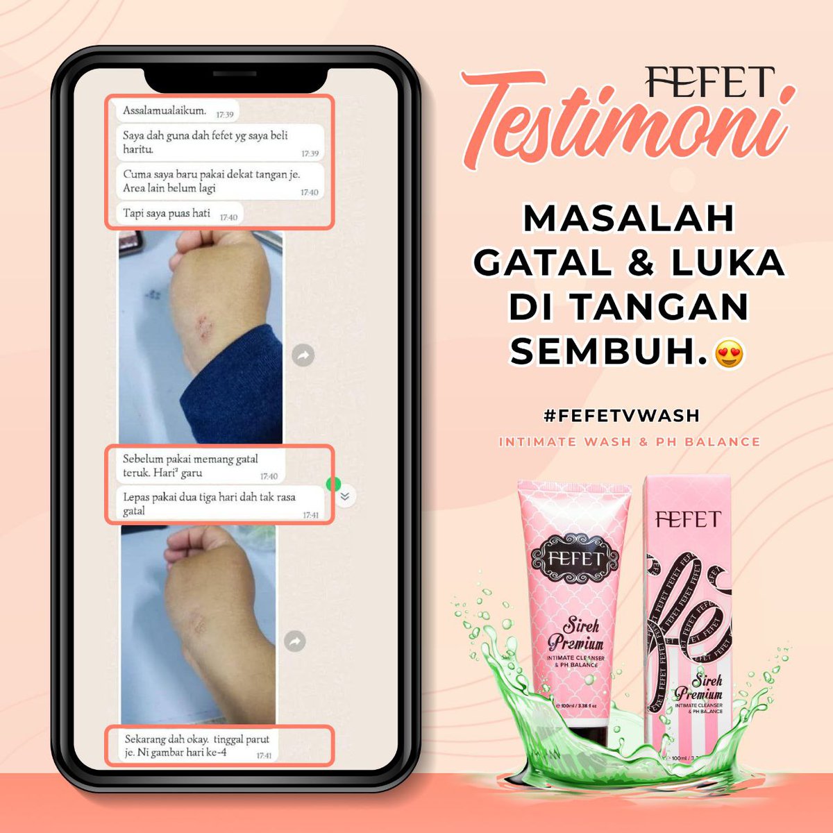 ChrisMami10's tweet photo. "Sebelum pakai memang gatal teruk.
Hari-hari garu..."

Memang rimas dan tidak selesa dibuatnya!

Nasib baik #fefetVwash serbaguna.
1 rumah 1 Fefet memang lega 🤗

#Fefet Lah!
The People's Happiness
#NakFefetLah #1Rumah1Fefet https://t.co/E4hzzl2oxR