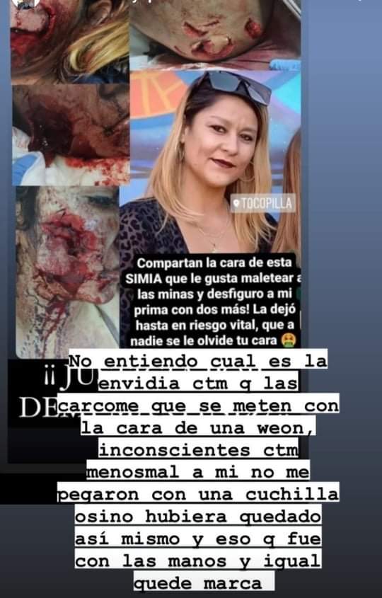 ingride48's tweet photo. Alerta morada en Tocopilla, 3 agresoras, la apuñalaron, la grabaron, la desnudaron, la horcaron, y le han desfigurado su rostro... De verdad queremos ser respetadas, si nosotras mismas nos atacamos?

#justiciaparadeni #tocopilla #alertamorada https://t.co/tOzCsh4VsR