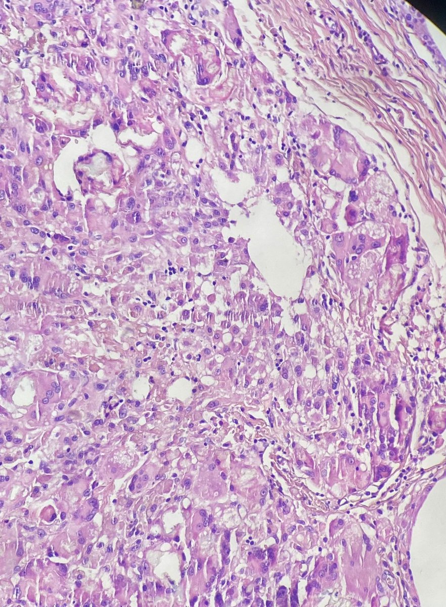 Andy_pathology's tweet photo. kidney https://t.co/VTKluh9DT8