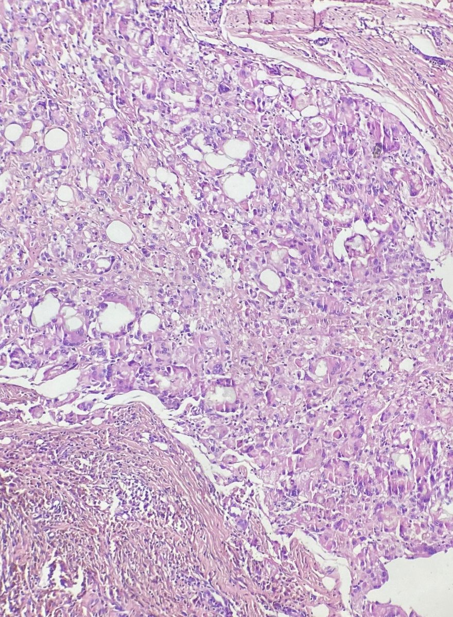 Andy_pathology's tweet photo. kidney https://t.co/VTKluh9DT8