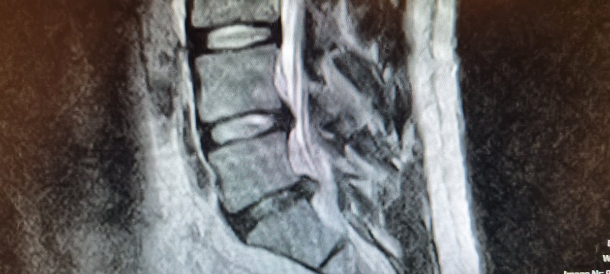 Henk Tempelman tweet media