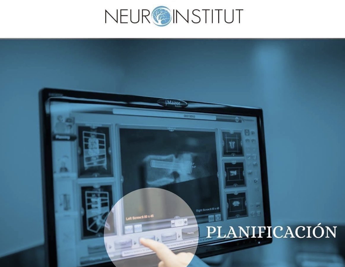 Neuroinstitut_'s tweet photo. Una de las cosas más #importantes que nos permite #Renaissance, de #Mazor Robotics es #planificar detalladamente una #operación previamente y trasladarla con exactitud a la hora de llevar a cabo la #cirugía https://t.co/JDKpsxwgm4