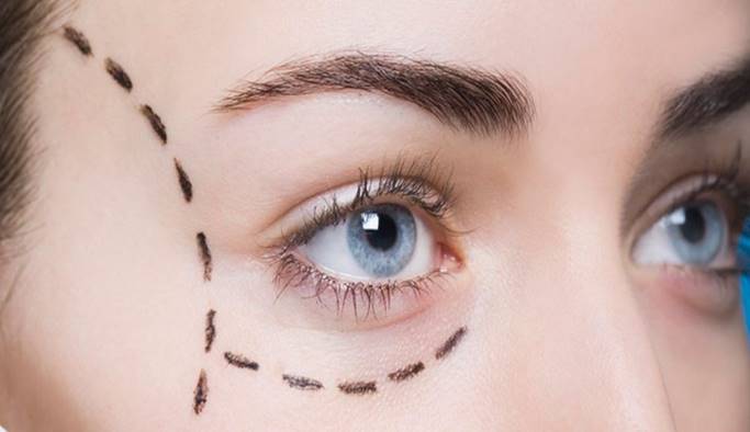NovovisionEsp's tweet photo. Rejuvenece tu mirada gracias a la blefaroplastia #salud #feedly https://t.co/ilUOv8DTr9 https://t.co/0Fg9Bm9xZp