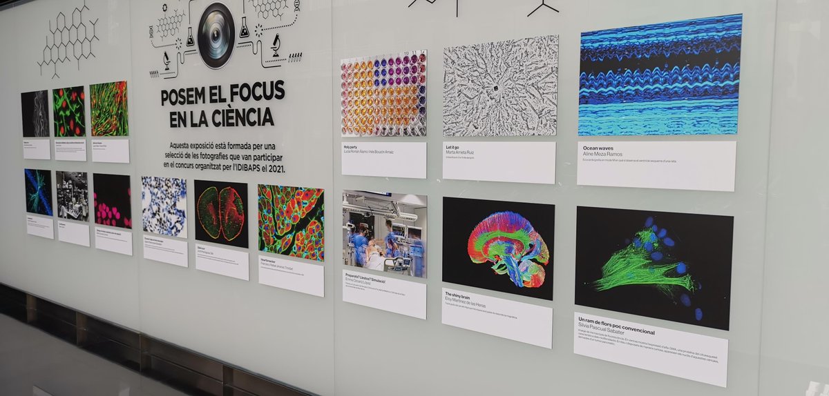 L'IDIBAPS estrena exposició de fotografia científica

L'exposició està instal·lada al vestíbul del Centre Esther Koplowitz (C/ Rosselló, 149-153 Barcelona). L'accés és lliure i gratuït.

Més informació👉bit.ly/3qevDbf