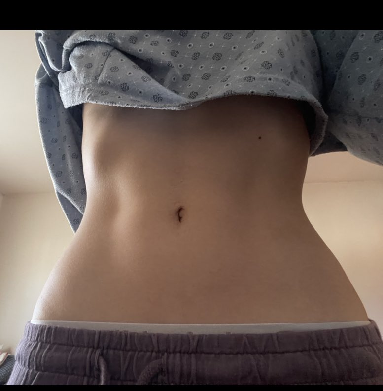 alcadd1ct's tweet photo. The progress tho…pics r 2 months apart 😮
#skinny #EDtwt #proana https://t.co/Xdu0UDIDmB