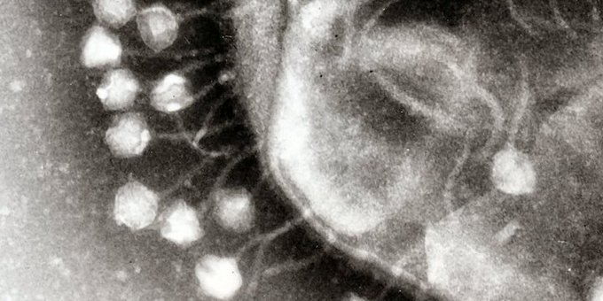 MicrobiolCurRes's tweet photo. Exploiting one #infection to control another: phages versus #mycobacteria
for more details:https://t.co/PIvTtEgu6t https://t.co/37XTyu1FxI