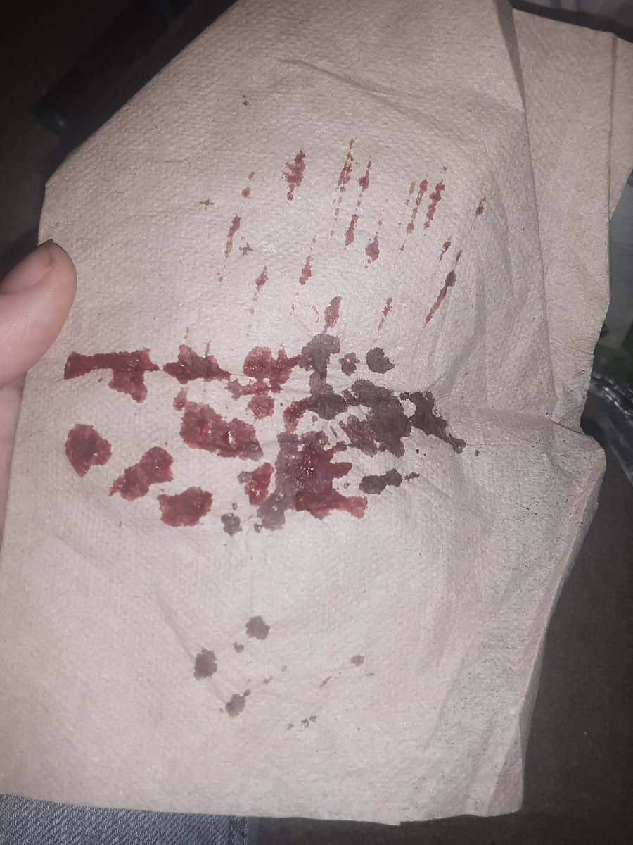 LSER66722307's tweet photo. TW//SH 
.
.
.
.
.
.
.
.
.
.
.
Got a new toy, thought I'd try it out raspberryfilling  redbreadtwt sh twt barcodetwt catscratchestwt styro twt ouchietwt https://t.co/teTYNLQsfX