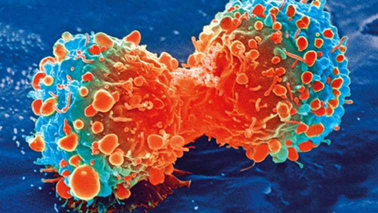 StatNano's tweet photo. Boosting Anti-cancer Action by Driving up Immunity at Tumor Site
https://t.co/wFoprPQvRx
#Anti_cancer #Tumor #immune_response #cancer #nanotechnology #immunotherapy_treatments #disease #mice_suggests #StatNano #NBIC https://t.co/JlZfRBsHpe