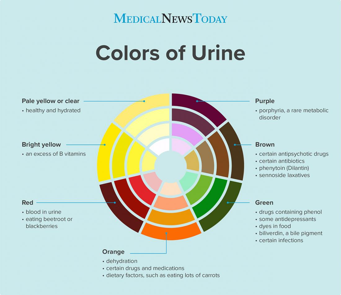 icherrycolalime's tweet photo. lana del rey albums as urine samples...a thread https://t.co/W3e2Q0Q5Fe