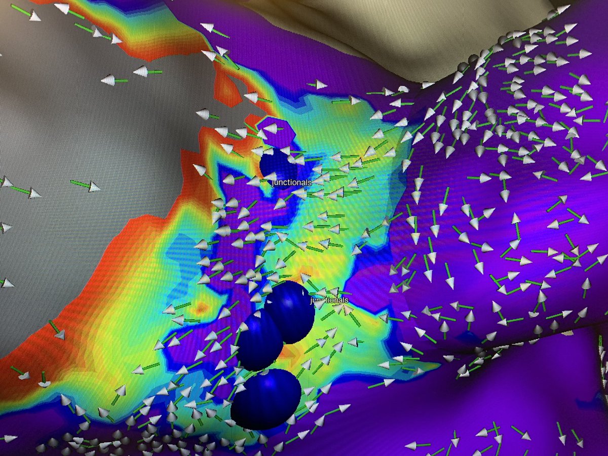 See AVNRT a whole new light! Begin seeing the circuitry before induction. Identify targets in pts that are difficult to induce. @AbbottCardio #AbbottEP #OnlyWithOT #EnsiteX #EPeeps