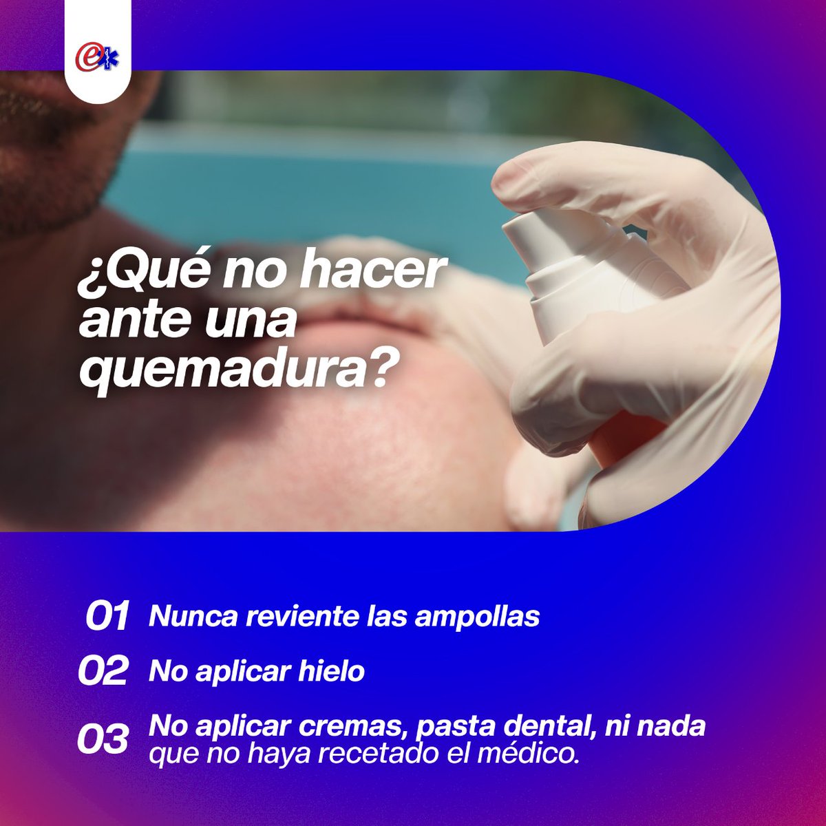 EMERGENCYCORP's tweet image. Estas son solo algunas recomendaciones que puede tener en cuenta en caso de presentar una quemadura. Pero recuerde visitar a un médico para que valore su caso y le brinde un tratamiento adecuado. 

#quemaduras #prevencion #salud