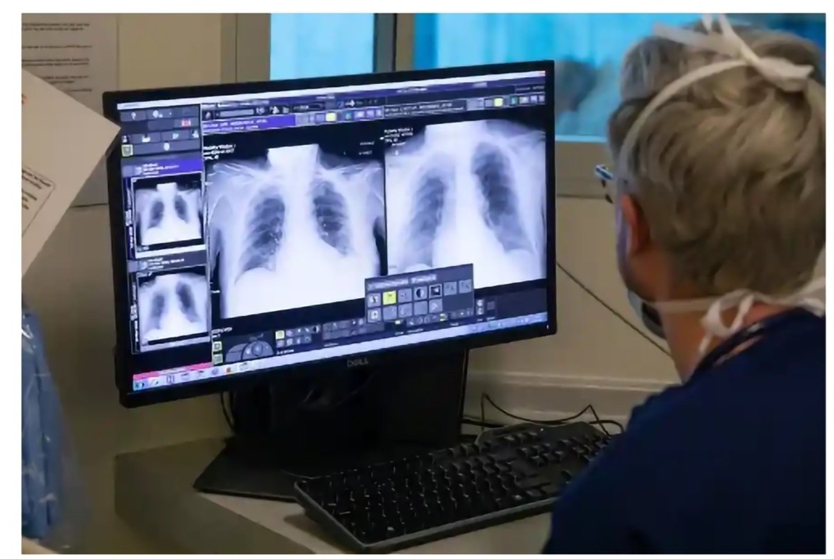 Throwback to FiY1 when I pretended to know what I was doing bringing up 2 CXR whilst The Guardian photographed me