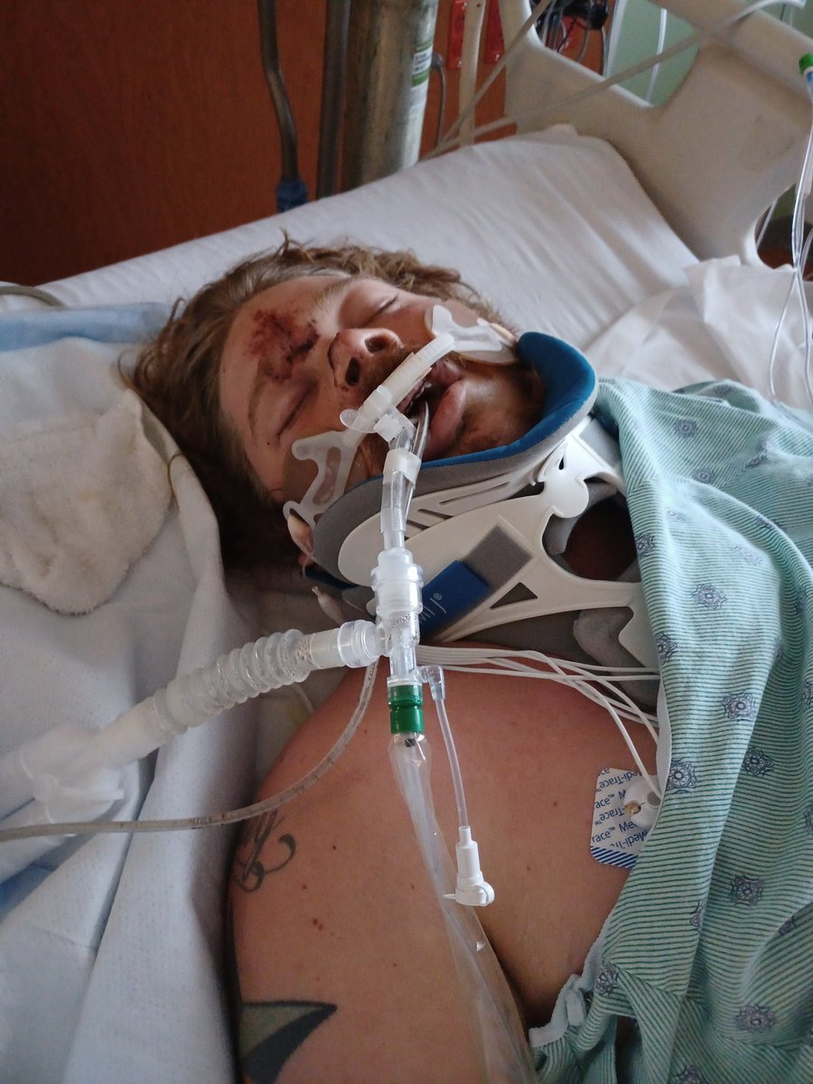 This is my son Brandon 💙 I am trying to be strong for him! God I need your help! Please make him whole again!!! Please keep him with me he is everything to me and I just can't imagine my life without him! I know your will will be done Amen!