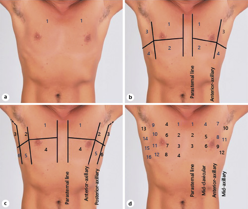 <a href="/Jwaitz/">Joshua Waitzman, MD PhD</a> <a href="/NephroP/">NephroPOCUS</a> <a href="/hswapnil/">Swapnil Hiremath @hswapnil.medsky.social</a> <a href="/nephrothaniel/">Nathaniel Reisinger</a> <a href="/NephJC/">Nephrology Journal Club</a> In case anyone is wondering what those 28 zones are... ( C) #nephjc karger.com/Article/FullTe…