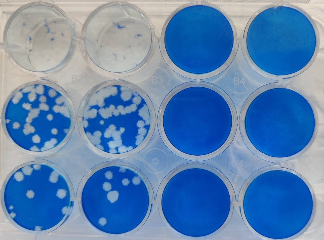 Our PhD student <a href="/CorellPaula/">Paula Corell</a> has finished her stay abroad <a href="/CVRinfo/">MRC-Uni of Glasgow Centre for Virus Research</a> @iiiglasgow <a href="/UofGlasgow/">University of Glasgow</a> (supported by an <a href="/EMBO/">EMBO</a> grant) during which she learned fascinating new virology techniques from <a href="/PabloRMurcia/">Pablo Murcia (he/him)</a> &amp; Kieran Dee [1/2]