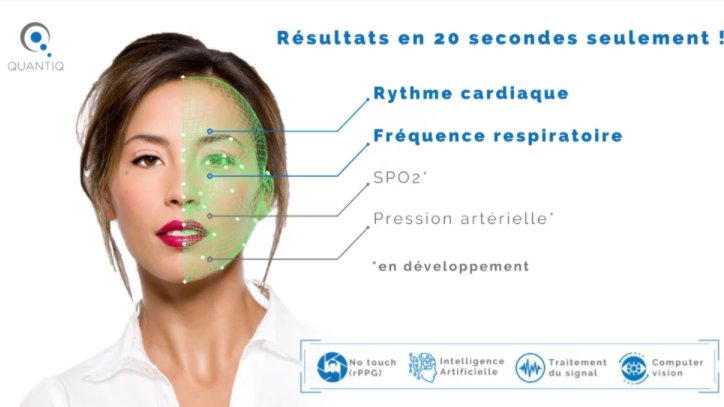 #HealthTech <a href="/niel_fabien/">Fabien Niel</a> [ENTRETIEN] #IA &amp; télémédecine :🧐Comment Quantiq.io 🇫🇷 transforme une simple caméra de smartphone en DM🤳. <a href="/Alain_Habra/">Alain Habra</a> détaille les applications possibles de la technologie, annonçant un lancement d'ici l'été 2022👉 healthandtech.eu/fr/article/vie…
