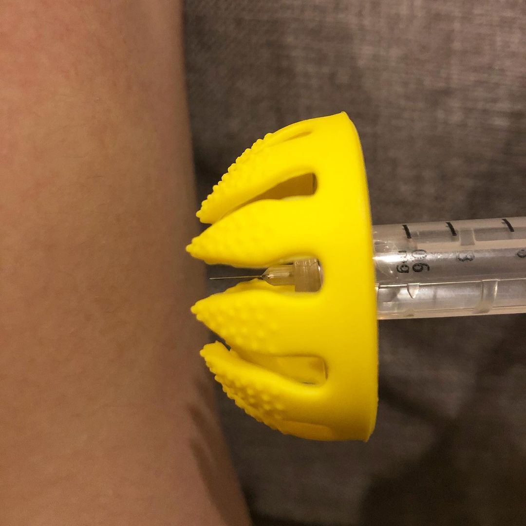 DiaSpider's tweet photo. How does DiaSpider work
1. Distracts atention
2. Prevents bruises on the body
3. Provides a safe puncture

More information about the product on our website: https://t.co/Ti3HHP0QI5 https://t.co/LXK2zRY7Ih
