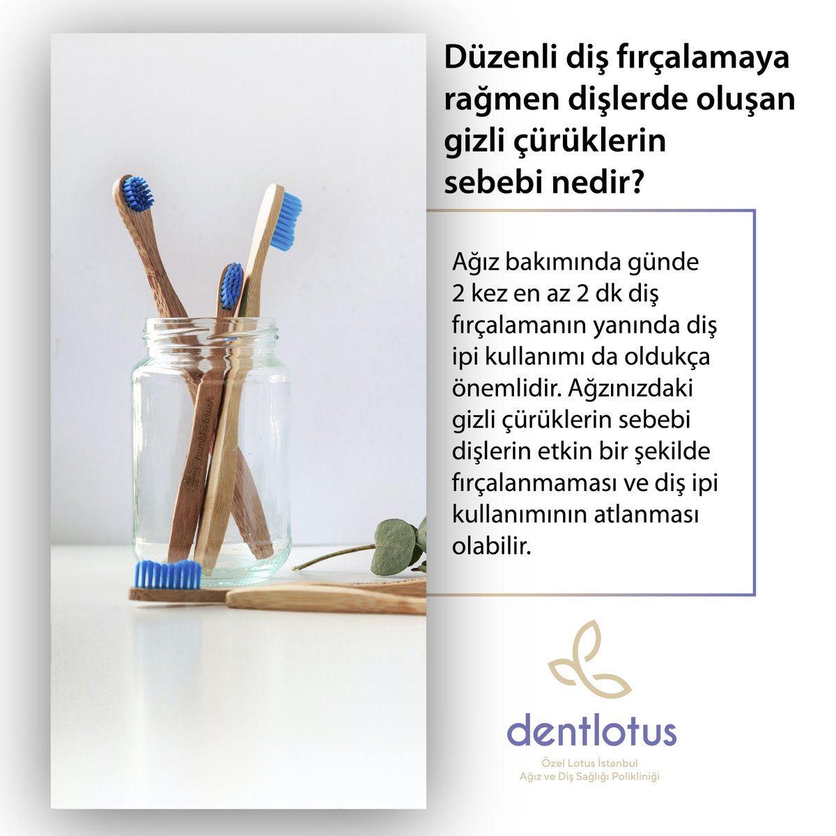 dentlotus's tweet photo. Ağız bakımında günde 2 kez en az 2 dakika diş fırçalamanın yanında diş ipi kullanımı da oldukça önemlidir. Ağızınızdaki gizli çürüklerin sebebi dişlerin etkin bir şekilde fırçalanmaması ve diş ipi kullanımının atlanması olabilir. https://t.co/yt3lmDgZhi