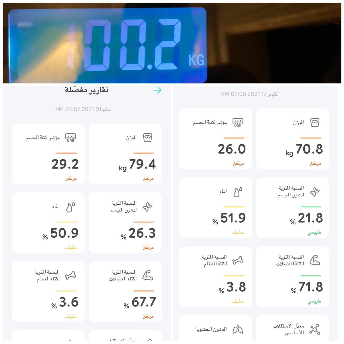 Rayan52398987's tweet photo. اللهم لك الحمداليوم خلصت سنة من تاريخ العملية الحمد لله راضي كل الرضا على النتيجة ومن نحية الشكل بس زعلان اني باقي ليا اربعة كيلو على المثالي وماقدرت اوصل، اخر اربعة اشهر النزول صار صعب بشكل ممل برغم اني التزمت في الرياضه بس الحمد لله على كل حال اللهم لك الشكر #رابطة_المتكممين https://t.co/yeunLqdE0Z
