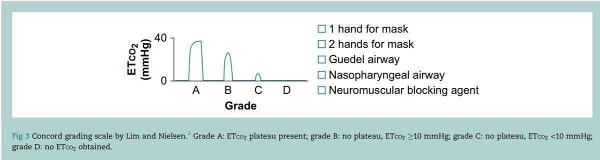 British Journal of Anaesthesia (@bjajournals) on Twitter photo The Concord grading system - Lim & Nielsen;
objective measure of ventilation success - analyse capnograph and document optimisation measures undertaken
<a href="/lowebrad/">Dr Pierre Bradley</a> and Dr Craig Lyons describe this in the #BJAEducation
#Airway @dastrainees <a href="/AirwayInfo/">airway.management</a>
bjaed.org/article/S2058-… The Concord grading system - Lim & Nielsen;
objective measure of ventilation success - analyse capnograph and document optimisation measures undertaken
<a href="/lowebrad/">Dr Pierre Bradley</a> and Dr Craig Lyons describe this in the #BJAEducation
#Airway @dastrainees <a href="/AirwayInfo/">airway.management</a>
bjaed.org/article/S2058-…