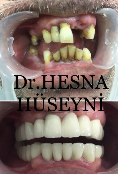 Dr.Hesna Huseyni (@hesnahuseyni) on Twitter photo 