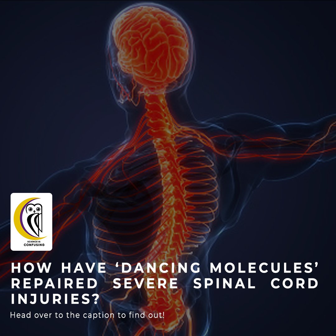 Team_SiC_2020's tweet photo. How have "Dancing Molecules" repaired sever spinal cord injuries?
Written by: Avanti Basu
Reviewed by: Rohini Bhattacharjya
Design by: Debanjan Basu
Click to know more: https://t.co/rLuUr36PAH
#science #paralysis #biotechnology #dancingmolecules #molecularbiology #spine https://t.co/37RQ6cbs3e