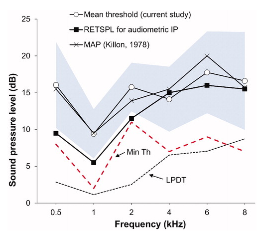ijaonline's tweet photo. #Calibration and initial validation of a low-cost computer-based screening #audiometer coupled to consumer insert phone-earmuff combination
#NewArticle #IJA by Seluakumaran & Shaharudi
#AuDpeeps #Audiology
https://t.co/Ewe4UhQKqW https://t.co/bo3W6rC9jY